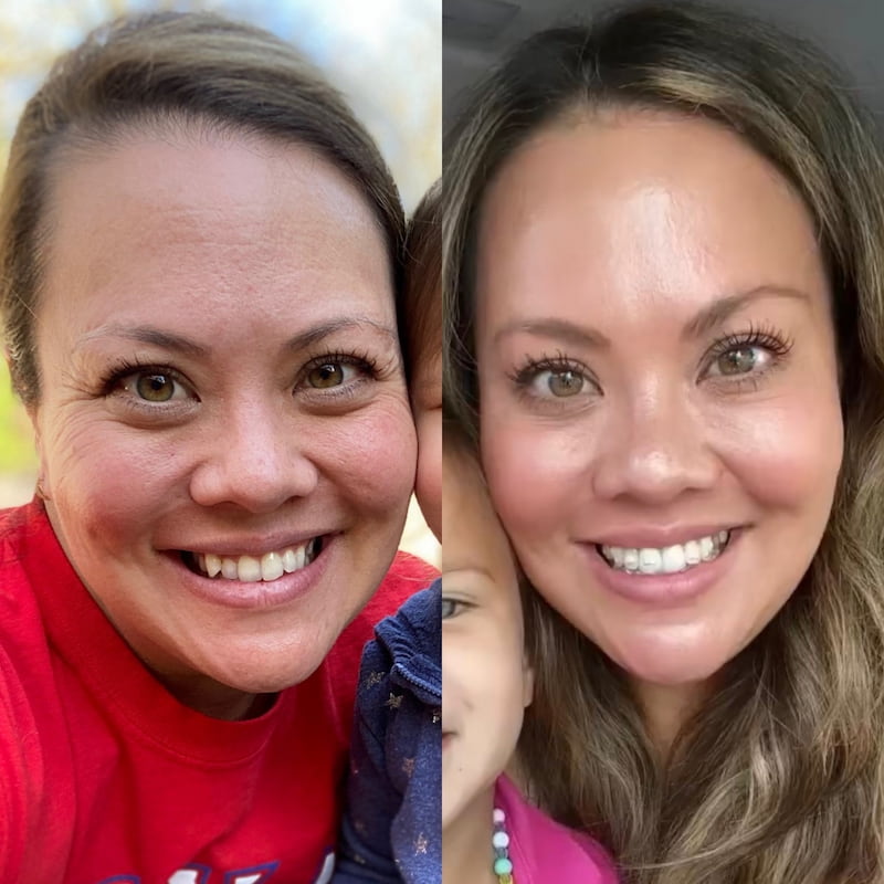 Kim before and after medical-grade skincare