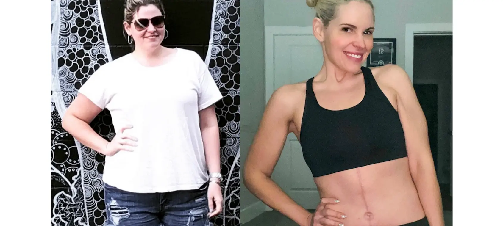 Jessica's before and after weight loss transformation