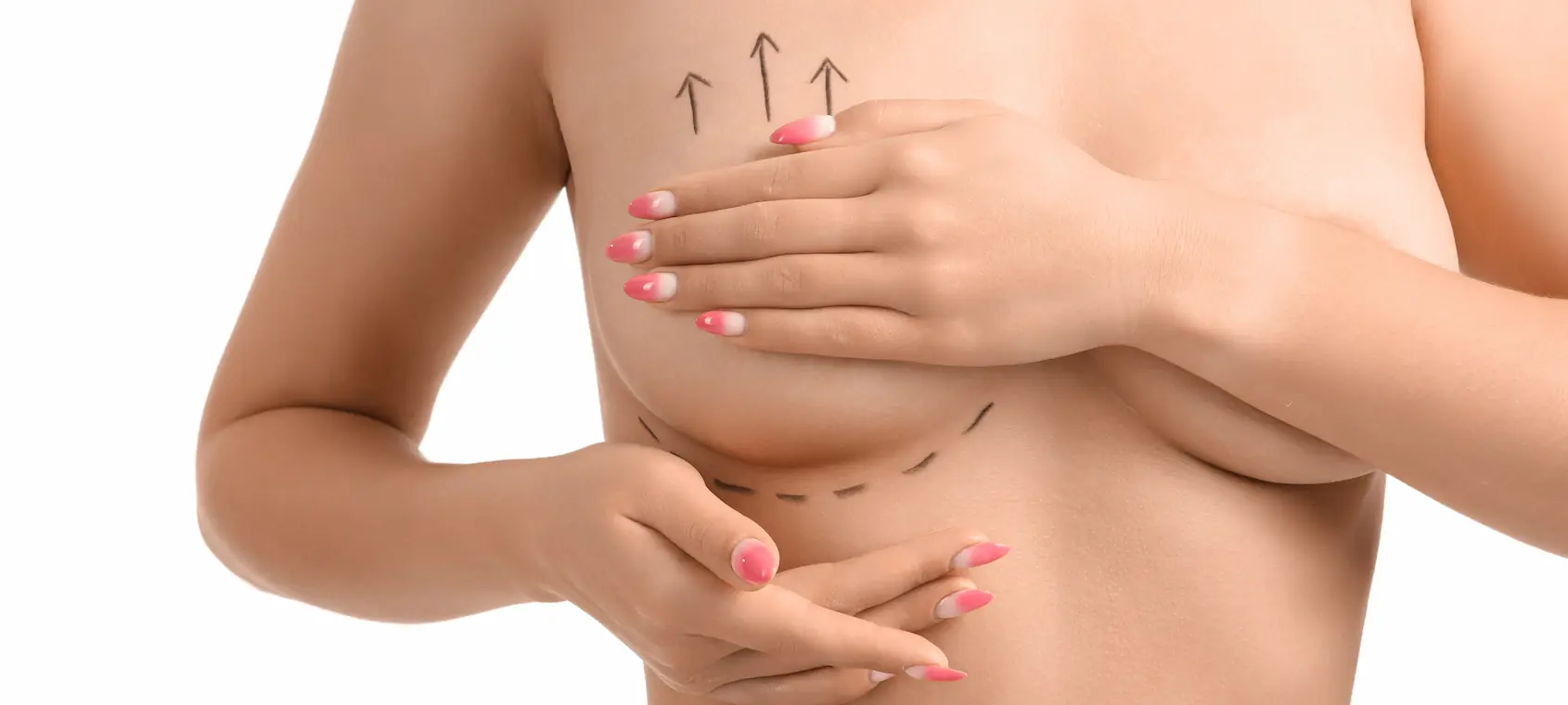 breast asymmetry correction procedure thumbnail