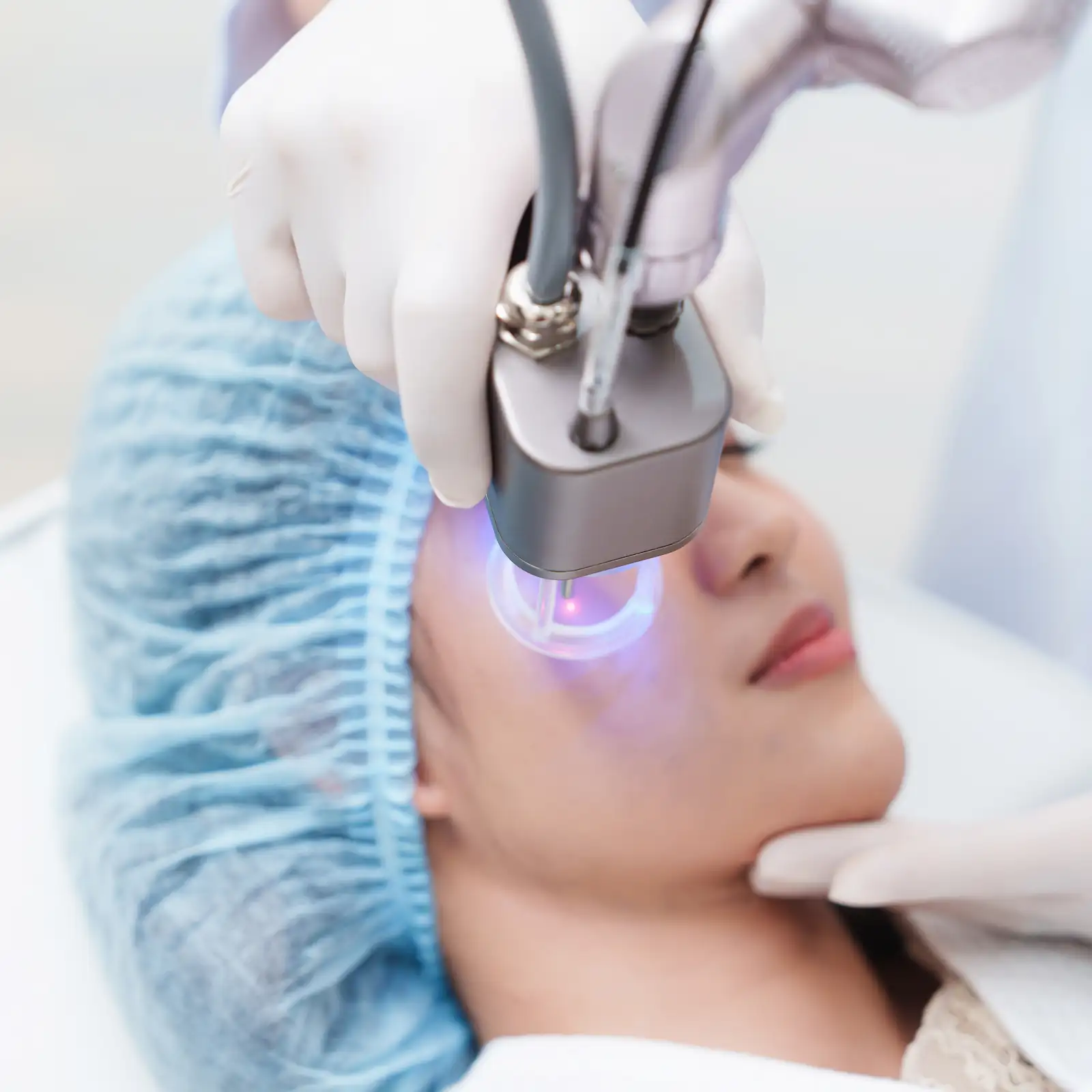 fraxel laser resurfacing treatment procedure